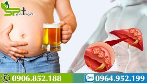 cach-phong-ngua-ung-thu-gan