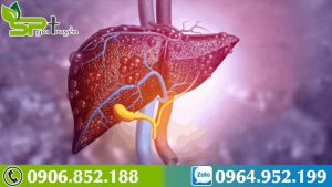 benh-u-mau-trong-gan