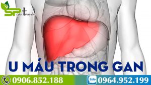 kham-pha-nhung-cay-thuoc-chua-u-mau-trong-gan