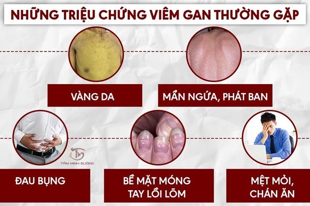 cac-van-de-cua-mot-la-gan-khong-khoe-manh